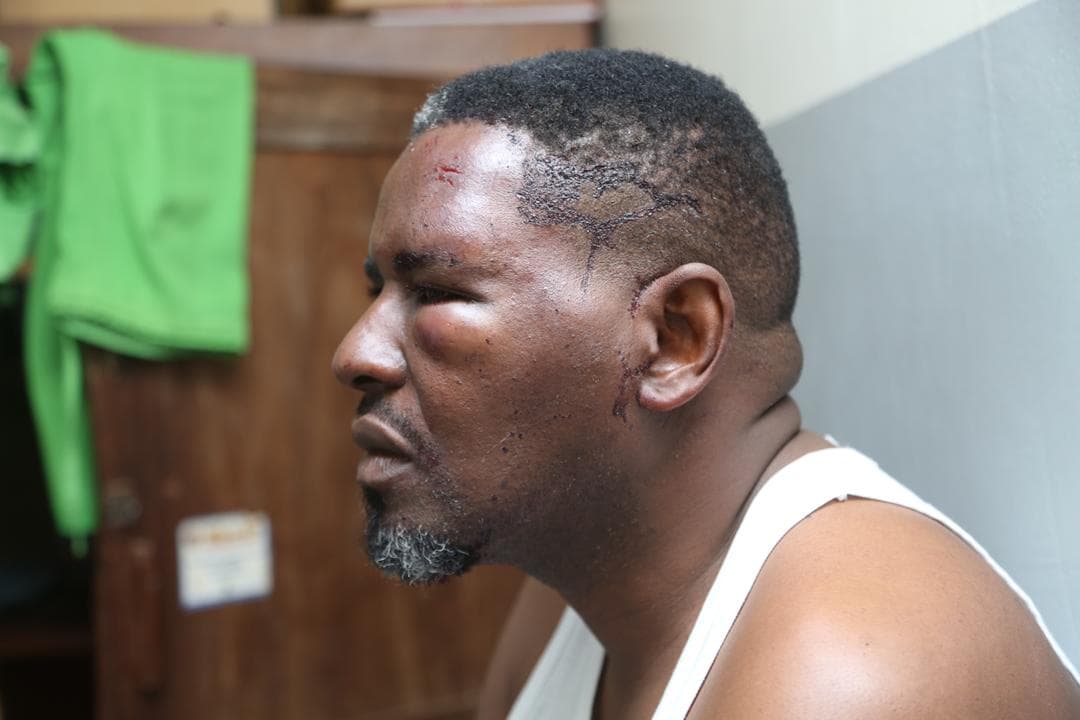 Police Rescue KCCA PRO Robert Kalumba After Attack by NUP Hooligans